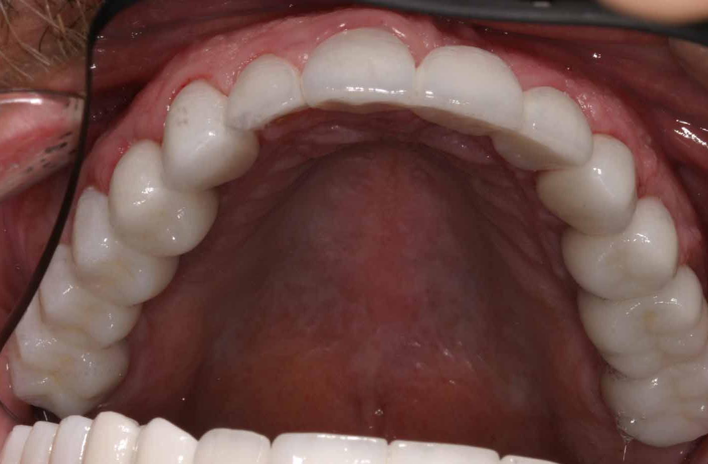 Cosmetic Dentist Fort Myers Cape Coral Naples FL